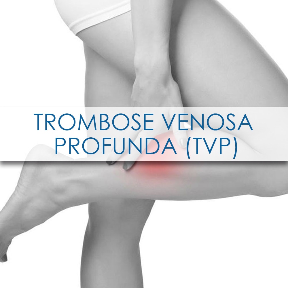 O Que Trombose Venosa Profunda Tvp Lobatocirurgiavascular Br